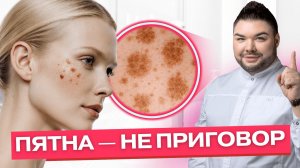 Старческие пятна на коже: что это такое, опасны ли они и можно ли их убрать