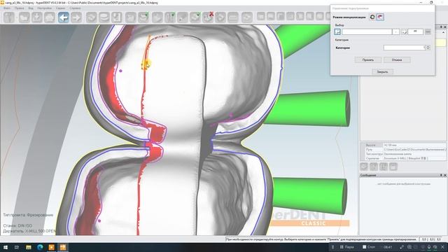 Балка и ответка на культях смотреть онлайн