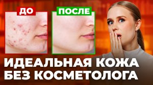Забудь про скрабы для лица! Вот что очистит твою кожу от черных точек и закрытых комедонов
