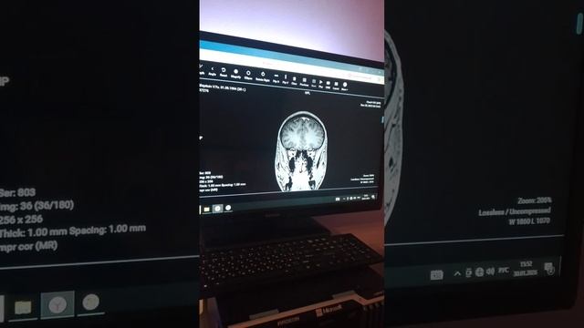 МРТ моей головы