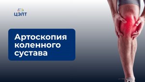Артроскопия коленного сустава