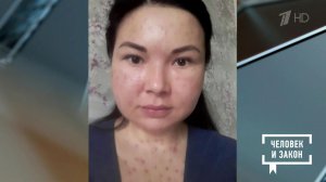 Контроль качества. Пластическая хирургия. Человек и закон. Фрагмент выпуска от 30.01.2026