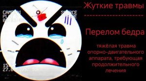 жуткие травмы/гд лица