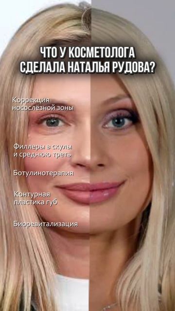 Что у косметолога сделала Наталья Рудова? смотреть онлайн