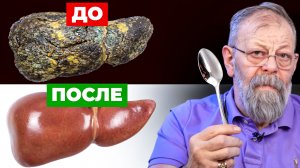 ПРЕДМЕТ, КОТОРЫЙ СНИМАЕТ СПАЗМ ПЕЧЕНИ ЗА МИНУТУ