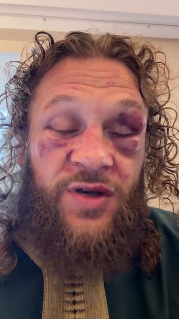 Рафаэль Физиев высказался после поражения от Маурисио Руффи на UFC325 смотреть онлайн