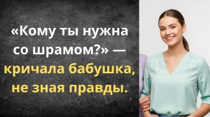 Испортила лицо и сразу вышла замуж | Истории из жизни