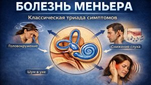 Болезнь Меньера