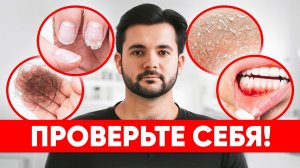 Избегайте этих БОЛЬШИХ ошибок при приеме витаминов группы В! Как правильно употреблять витамины?