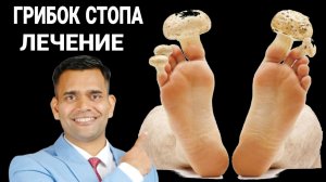 КАК НАВСЕГДА  ИЗБАВИТЬСЯ ОТ ГРИБКА СТОП.