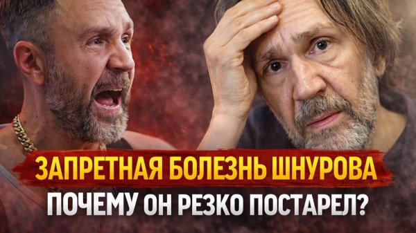 Что случилось со Шнуровым? Его больше не узнать! Запретная болезнь Шнурова, почему он резко постарел