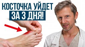 5 минут в день, и ноги ЗДОРОВЫ! / Как НАВСЕГДА избавиться от КОСТОЧКИ на стопе БЕЗ ОПЕРАЦИИ?