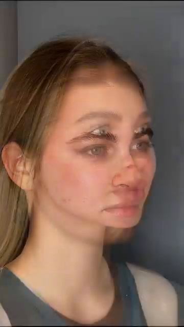 Любить значит поддерживать #сергейсвиридов #липосакцияподбородка смотреть онлайн