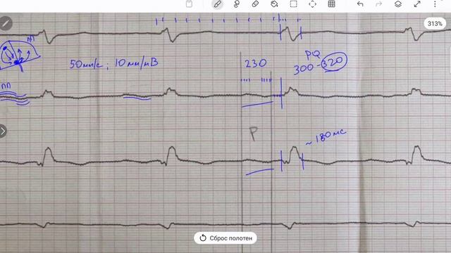 Очень широкие Р. В чем причина?