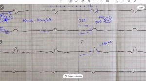 Очень широкие Р. В чем причина?