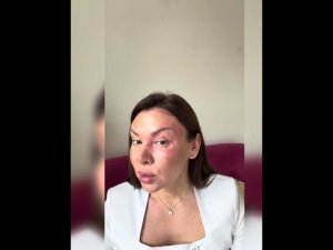 Сравниваем mezoeye c71 с аналогом