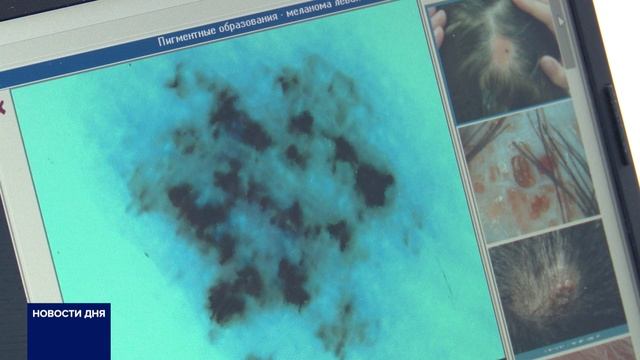 ОРЕНБУРГСКИЕ ОНКОЛОГИ НАПОМНИЛИ, КАК НЕ ПРОПУСТИТЬ БОЛЕЗНЬ смотреть онлайн