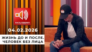 Жизнь до и после. Человек без лица. Пусть говорят. Выпуск от 04.02.2026