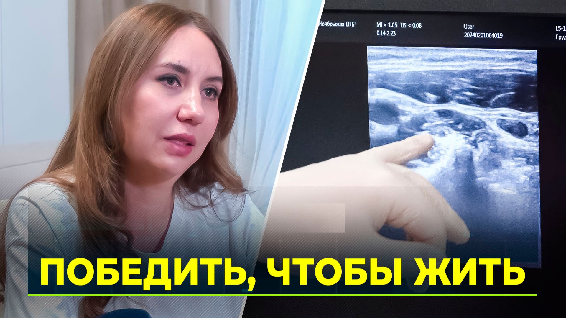 Сегодня во всём мире отмечают День борьбы против рака смотреть онлайн