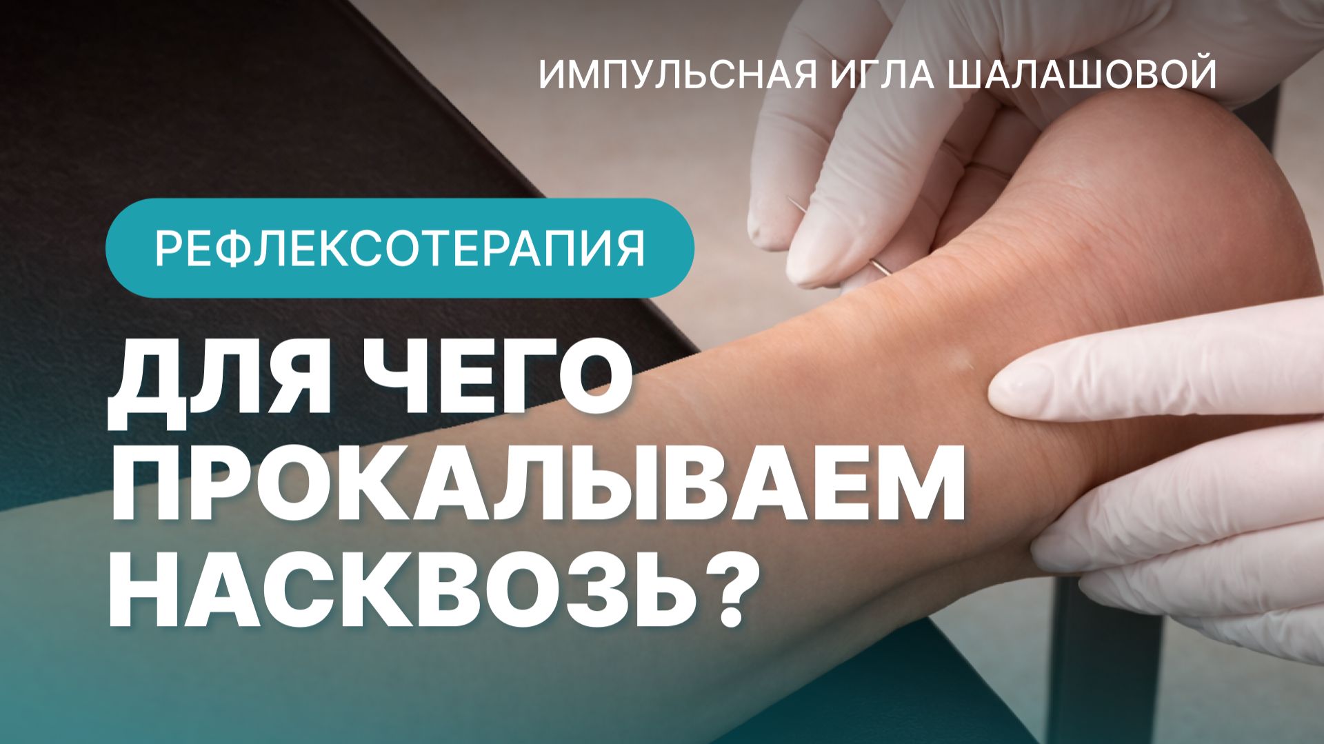для чего прокалываем насквозь. Рефлексотерапия курсы