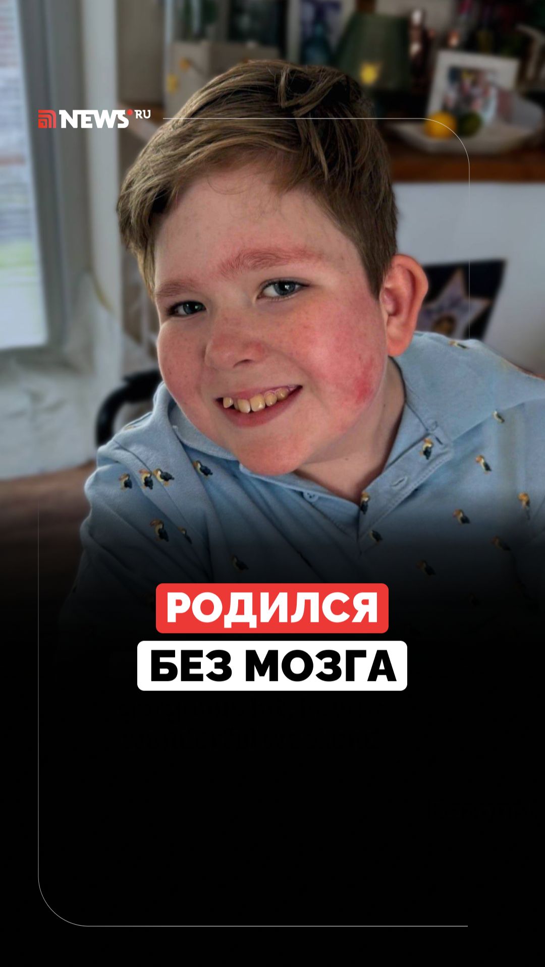 Любовь творит чудеса. Невероятная история мальчика без мозга смотреть онлайн