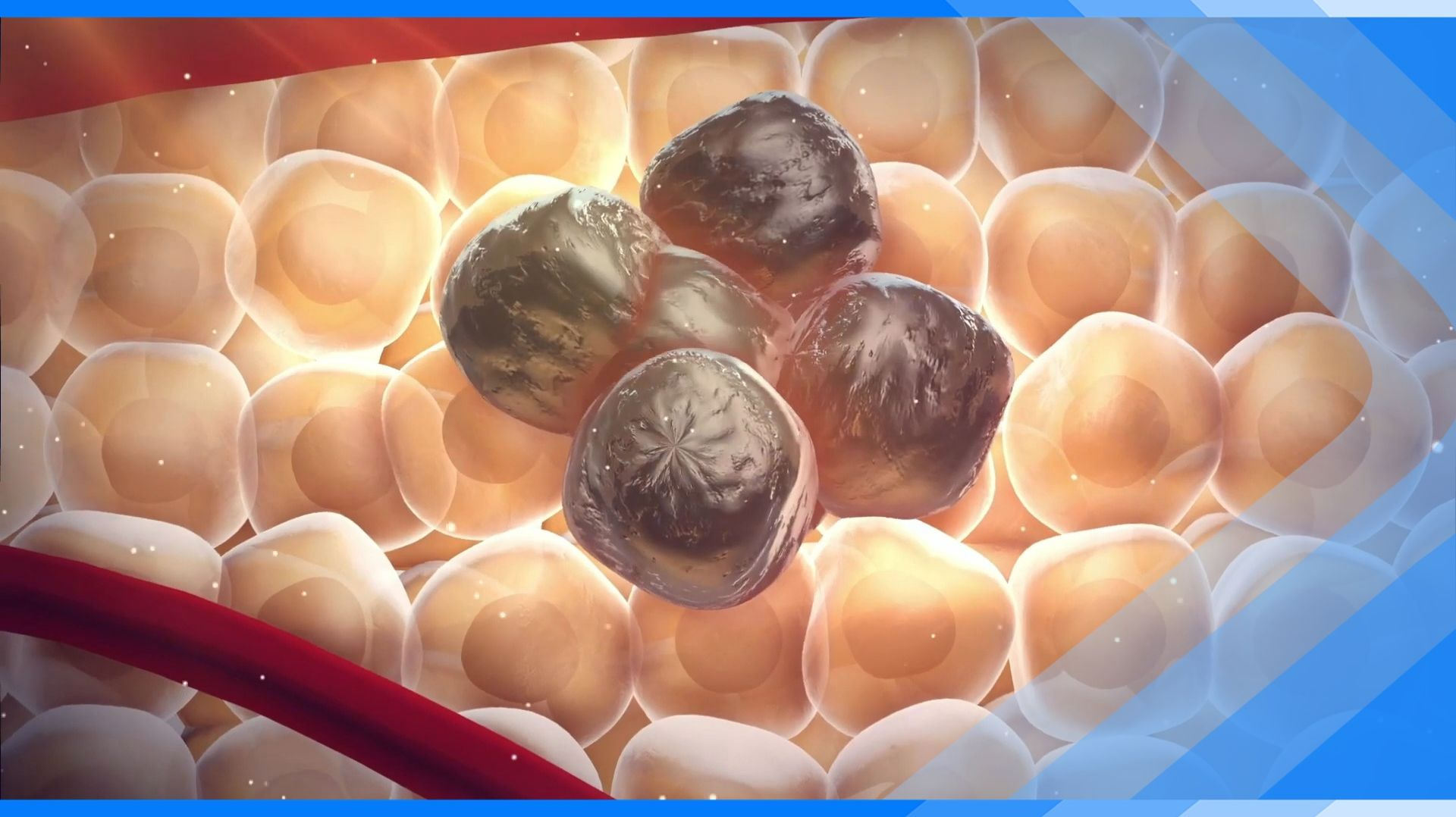 04.02.2026 Рак молодеет. Медики рассказали, как свести риск заболеть к минимуму смотреть онлайн