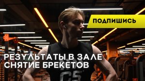 Мои зубы и тренировки.