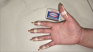 Руки и суставы перестанут болеть. Используйте ветки этого дерево или обычные спички