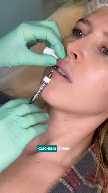 Почему контурная пластика губ так популярна?