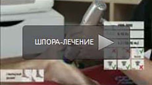 Плантарный фасцит лечение увт