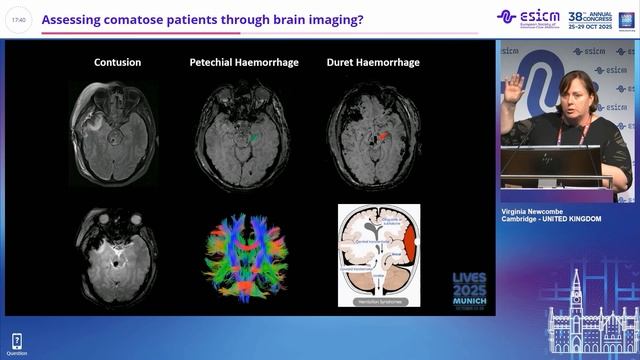 Assessing comatose patients through brain imaging Virginia Newcombe