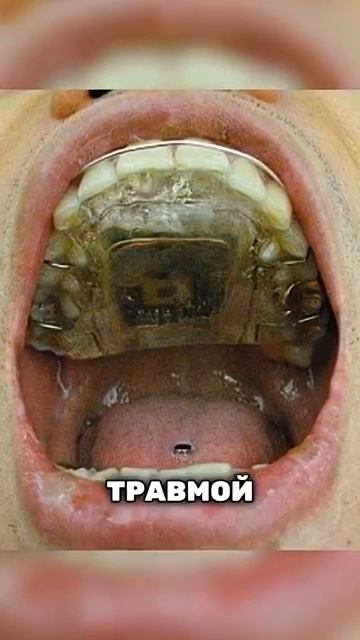 Эти фотографии 🖼️ очень старые, но не менее увлекательные. 😊 смотреть онлайн