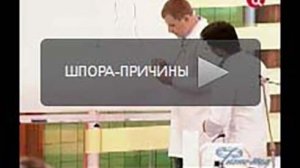 Пяточная шпора причины заболевания
