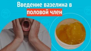 🤨 Введение вазелина в половой член. Клинический случай № 1737