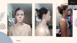 Запись эфира "Лифтинг лица"