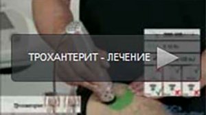 Трохантерит лечение ударно волновая терапия