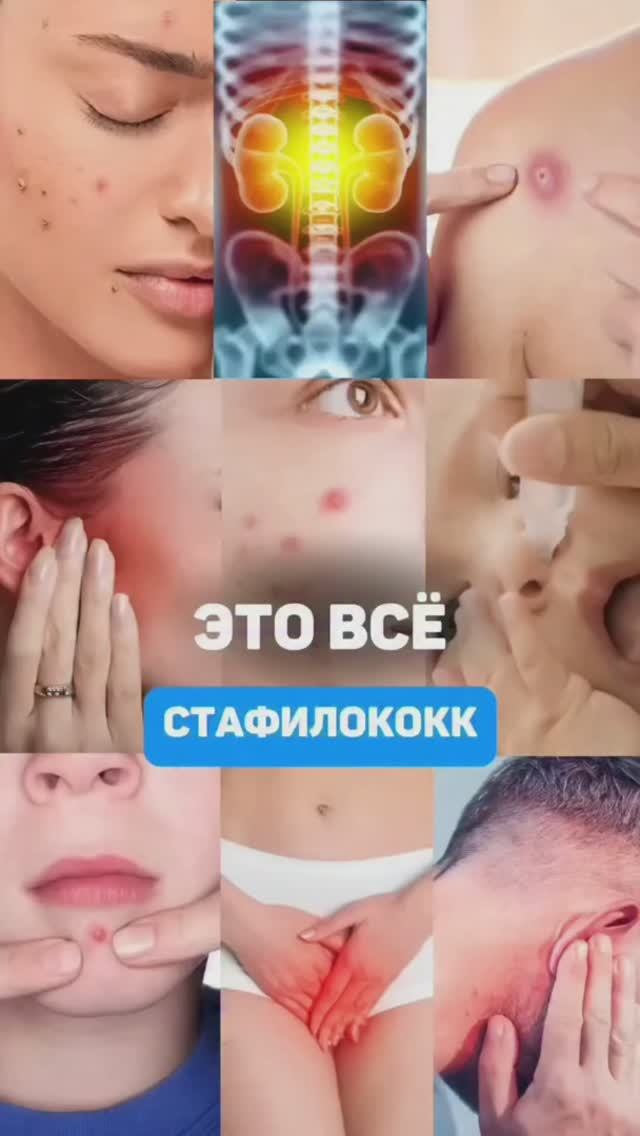Причина этих болезней - стафилококковая инфекция. Семейный доктор Алена Братишко смотреть онлайн