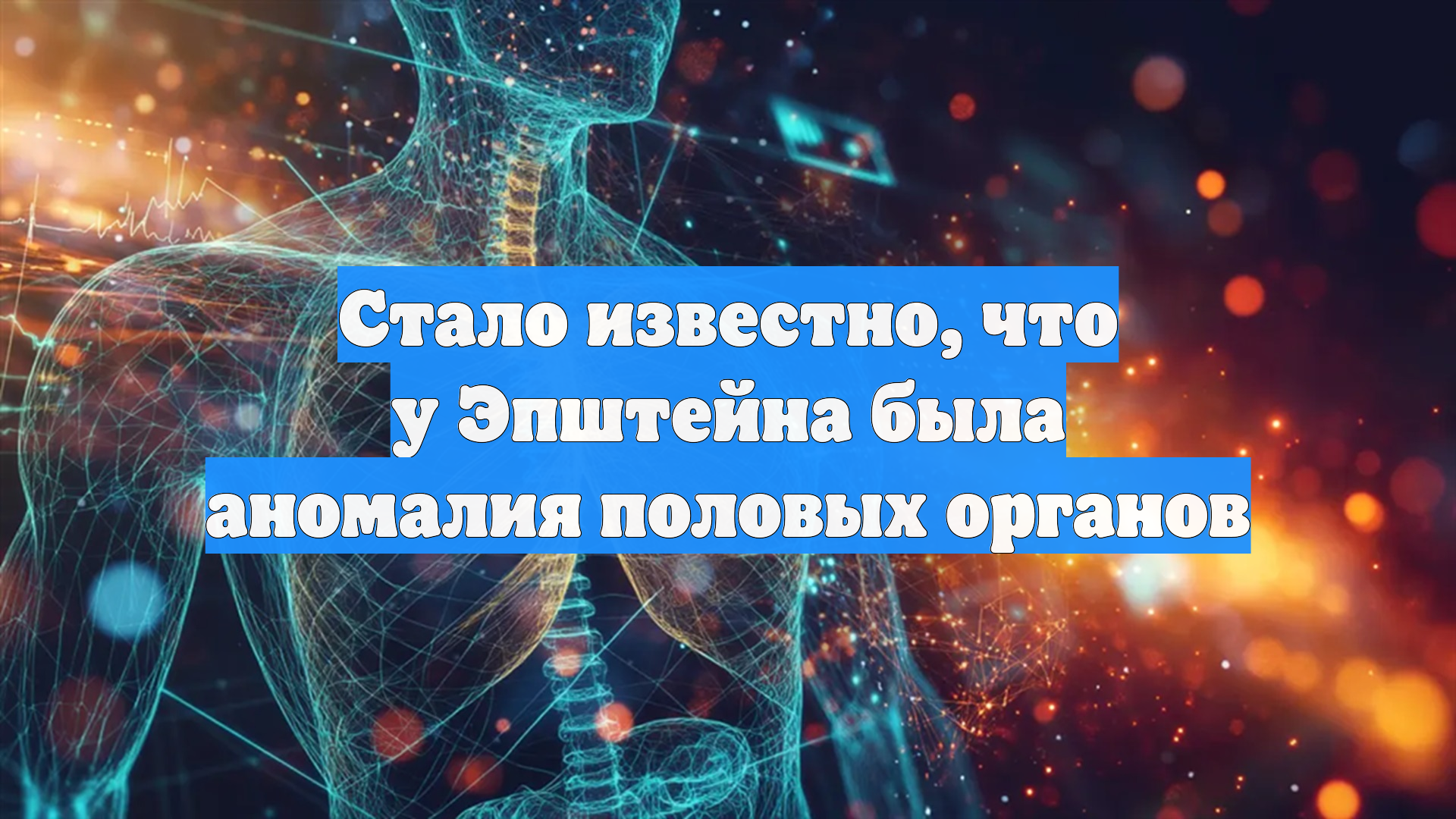 Стало известно, что у Эпштейна была аномалия половых органов