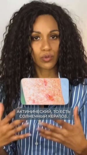 Показания к пилингу Джесснера