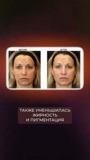 Экзосомы в косметологии: история исследований