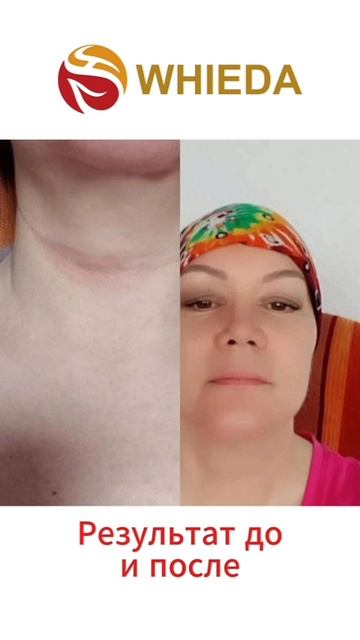 Активатор - терагерцевые волны