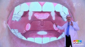 Ангина: лечим правильно - без осложнений. Жить здорово! Фрагмент выпуска от 30.01.2026