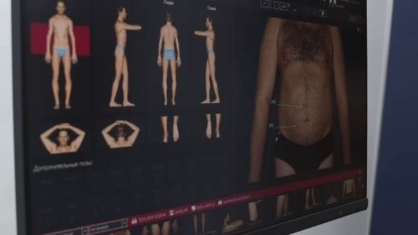 Как понять что у тебя рак кожи за 20 минут