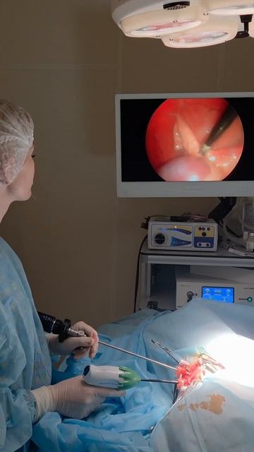 Лапароскопическая стерилизация смотреть онлайн