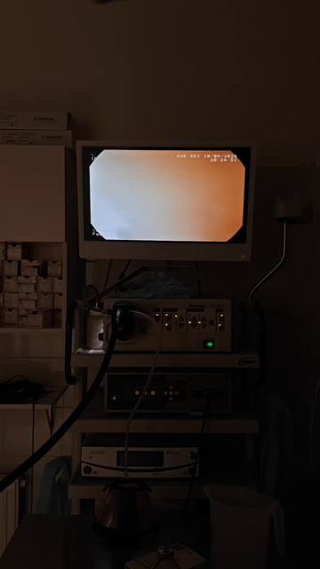 Гастроскопия с извлечением инородного тела из желудка кота смотреть онлайн