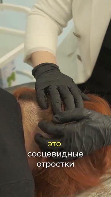 Как правильно делать хиджаму на голову? #hijama #хиджама #баночныймассаж #оздоровление смотреть онлайн