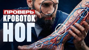 6 признаков плохого кровообращения в НОГАХ – проверь БЕЗ врача