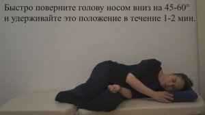Манвер Appiani (Gufoni) при ДППГ каналолитиазе правого горизонтального  канала
