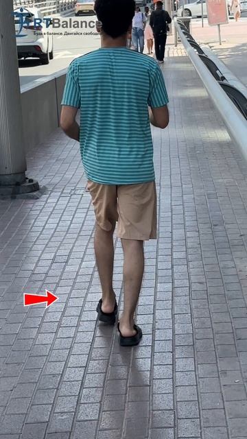 Косолапость и внутренний завал стоп = передний наклон таза смотреть онлайн