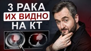 Их хорошо видно: коварные опухоли, которые КТ покажет даже на 1 стадии!
